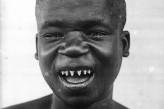 Teeth-sharpening culture that was prevalent in the 18th century. AdvertAfrica News on afronewswire.com: Amplifying Africa's Voice | afronewswire.com | Breaking News & Stories