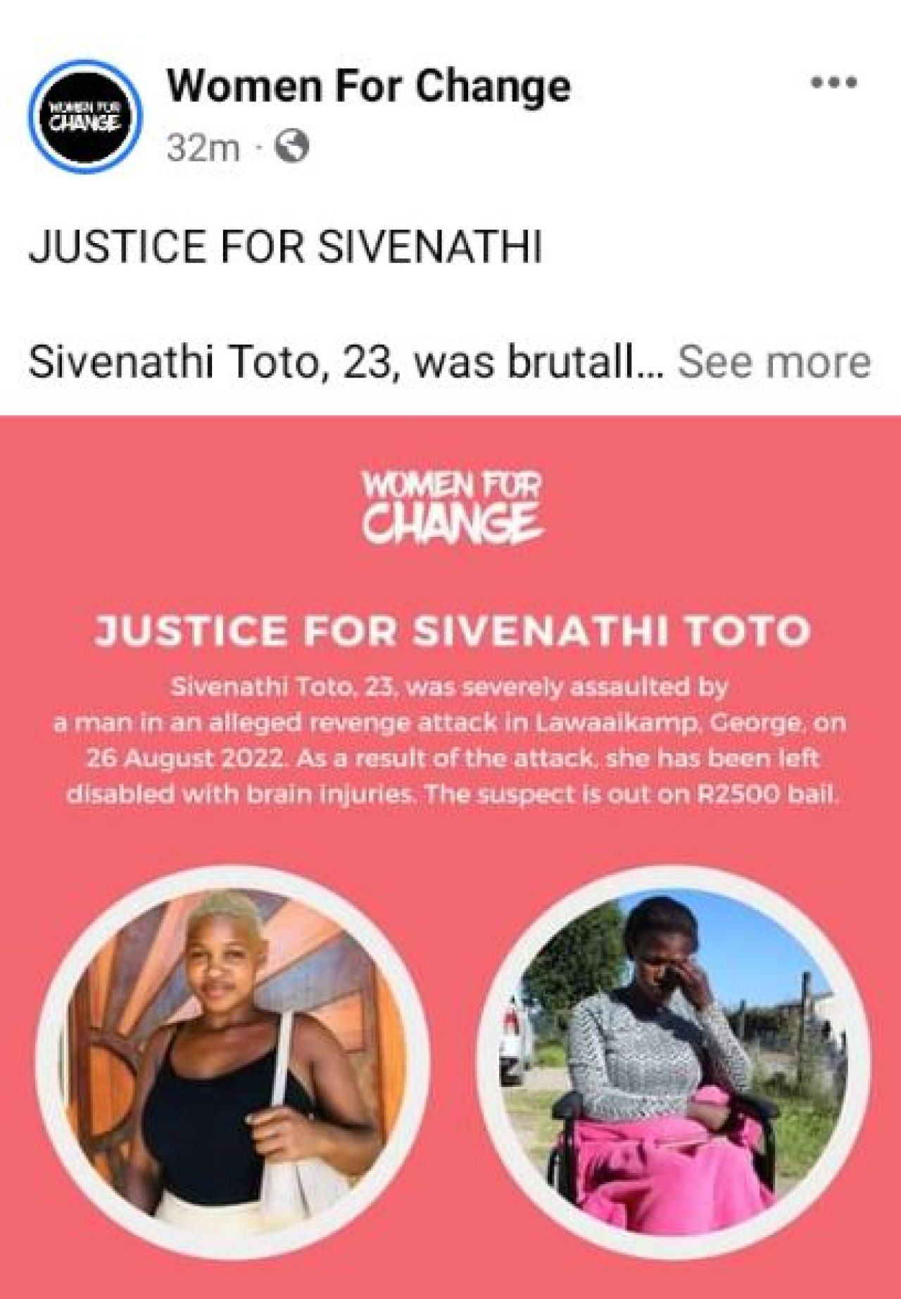 23-year-old Sivenathi Toto, left paralyzed and brain damaged after brutal attack by her boyfriend's rival. AdvertAfrica News on afronewswire.com: Amplifying Africa's Voice | afronewswire.com | Breaking News & Stories