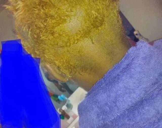 Girl loses all her hair overnight to fake dye applied on her by hairstylist (Photos) Afro News Wire