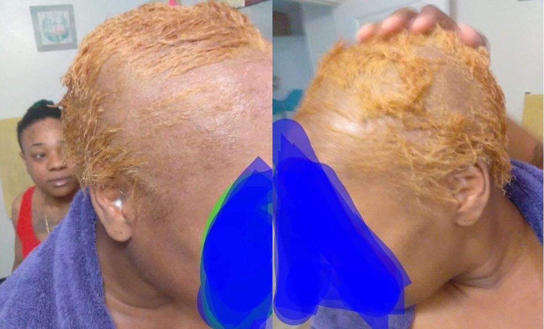 Girl loses all her hair overnight to fake dye applied on her by hairstylist (Photos) Afro News Wire
