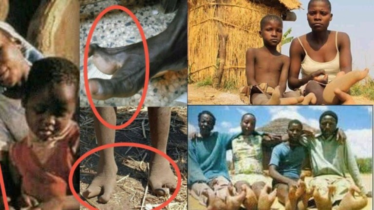 Meet the Vadoma tribe of Zimbabwe with only two toes and forbidden to marry Afro News Wire