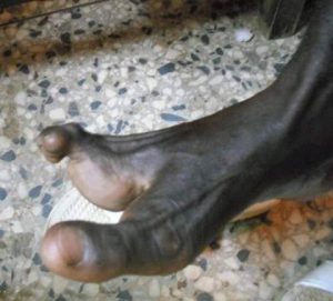 Meet the Vadoma tribe of Zimbabwe with only two toes and forbidden to marry Afro News Wire