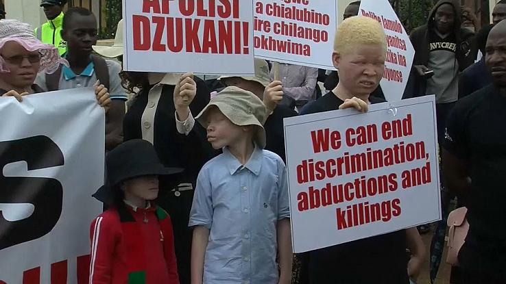 A Malawian court sentenced 3 albino murderers to 155 years in prison. Afro News Wire