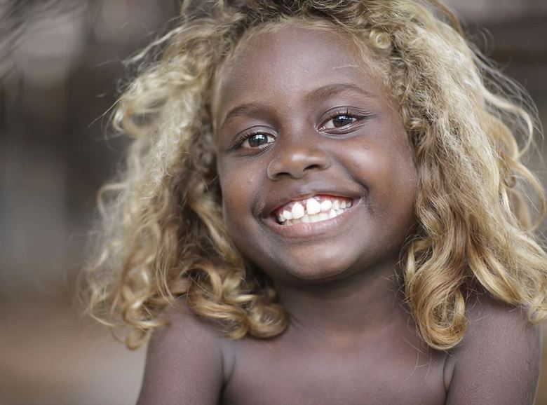 Meet the only naturally black blondes in the world. Afro News Wire